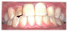 CASE #31: Cosmetic Restoration (before) CASE #31: Cosmetic Restoration (before)