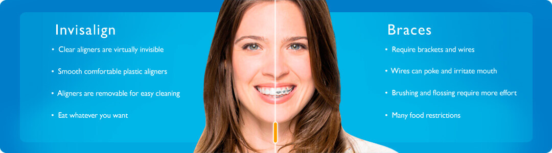 Invisalign Route 9 Dental