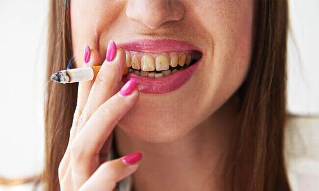 Smoking and Oral Health Copley Dental - Dental Information - Smoking and Oral Health